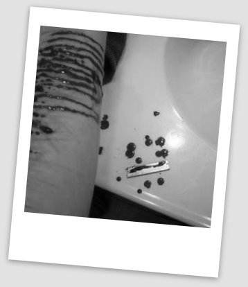 68747470733a2f2f7062732e7477696d672e636f6d2f6d656469612f434b345261444f57774141796c59772e6a7067